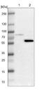 LIM Domain Kinase 2 antibody, NBP1-85783, Novus Biologicals, Western Blot image 