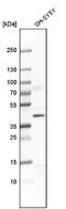 DDB1- and CUL4-associated factor 7 antibody, NBP1-92589, Novus Biologicals, Western Blot image 
