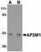 AP-2 complex subunit mu antibody, LS-C108514, Lifespan Biosciences, Western Blot image 