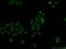 FACT antibody, 15696-1-AP, Proteintech Group, Immunofluorescence image 