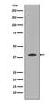 Mme antibody, M01520, Boster Biological Technology, Western Blot image 