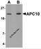 Anaphase-promoting complex subunit 10 antibody, 5735, ProSci Inc, Western Blot image 