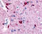 Potassium Calcium-Activated Channel Subfamily N Member 2 antibody, GTX54829, GeneTex, Immunohistochemistry paraffin image 