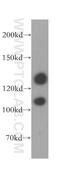 WARTS antibody, 17049-1-AP, Proteintech Group, Western Blot image 