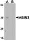 TNFAIP3 Interacting Protein 3 antibody, A10336, Boster Biological Technology, Western Blot image 