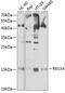 Regenerating Family Member 3 Alpha antibody, GTX55778, GeneTex, Western Blot image 