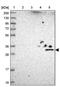 UTP23 Small Subunit Processome Component antibody, PA5-60705, Invitrogen Antibodies, Western Blot image 