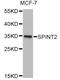 Serine Peptidase Inhibitor, Kunitz Type 2 antibody, orb373469, Biorbyt, Western Blot image 
