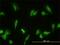 Glomulin, FKBP Associated Protein antibody, H00011146-M01, Novus Biologicals, Immunocytochemistry image 