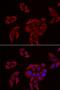 P2X purinoceptor 4 antibody, LS-C334869, Lifespan Biosciences, Immunofluorescence image 