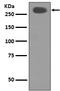 Acetyl-CoA carboxylase 2 antibody, M03668, Boster Biological Technology, Western Blot image 