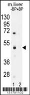 Sterile Alpha Motif Domain Containing 8 antibody, 56-191, ProSci, Western Blot image 