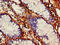 Vascular Endothelial Growth Factor B antibody, CSB-PA025834LA01HU, Cusabio, Immunohistochemistry paraffin image 