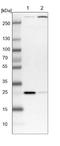 Cytochrome C Oxidase Assembly Factor 7 (Putative) antibody, NBP1-87392, Novus Biologicals, Western Blot image 