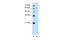 UDP Glucuronosyltransferase Family 1 Member A4 antibody, 30-239, ProSci, Western Blot image 