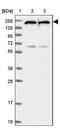 Uveal Autoantigen With Coiled-Coil Domains And Ankyrin Repeats antibody, NBP1-92554, Novus Biologicals, Western Blot image 