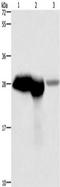 Calbindin 1 antibody, TA349732, Origene, Western Blot image 