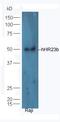RAD23 Homolog B, Nucleotide Excision Repair Protein antibody, orb157535, Biorbyt, Western Blot image 