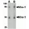 Sodium/hydrogen exchanger 1 antibody, TA306493, Origene, Western Blot image 