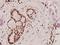 Maternal Embryonic Leucine Zipper Kinase antibody, A04038, Boster Biological Technology, Immunohistochemistry paraffin image 