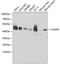 CXADR Ig-Like Cell Adhesion Molecule antibody, GTX53942, GeneTex, Western Blot image 