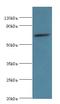 Sperm-associated antigen 16 protein antibody, LS-C378149, Lifespan Biosciences, Western Blot image 