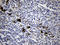 Fascin Actin-Bundling Protein 1 antibody, LS-C794019, Lifespan Biosciences, Immunohistochemistry paraffin image 