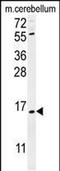 Ankyrin Repeat Domain 39 antibody, PA5-48134, Invitrogen Antibodies, Western Blot image 