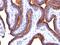 Mucin 1, Cell Surface Associated antibody, GTX34859, GeneTex, Immunohistochemistry paraffin image 