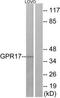 Uracil nucleotide/cysteinyl leukotriene receptor antibody, TA313943, Origene, Western Blot image 