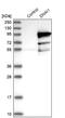 Dynein Axonemal Intermediate Chain 1 antibody, NBP1-84465, Novus Biologicals, Western Blot image 