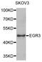 Early Growth Response 3 antibody, STJ29982, St John