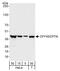 DNA Fragmentation Factor Subunit Alpha antibody, A301-420A, Bethyl Labs, Western Blot image 