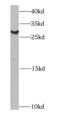 Charged Multivesicular Body Protein 2B antibody, FNab01659, FineTest, Western Blot image 