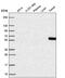 Nucleolar Complex Associated 4 Homolog antibody, NBP2-55061, Novus Biologicals, Western Blot image 