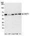 3-Oxoacid CoA-Transferase 1 antibody, A305-540A, Bethyl Labs, Western Blot image 