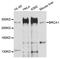 BRCA1 DNA Repair Associated antibody, abx125573, Abbexa, Western Blot image 