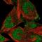 F-Box Protein 41 antibody, NBP2-58157, Novus Biologicals, Immunocytochemistry image 