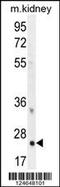 Homeobox protein Hox-B6 antibody, 56-006, ProSci, Western Blot image 