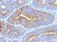 Thomsen-Friedenreich Antigen antibody, V3080SAF-100UG, NSJ Bioreagents, Immunofluorescence image 