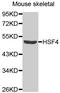 Heat Shock Transcription Factor 4 antibody, MBS129662, MyBioSource, Western Blot image 
