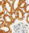 NADH:Ubiquinone Oxidoreductase Subunit C2 antibody, 61-058, ProSci, Immunohistochemistry frozen image 