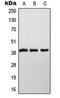 NADH:Ubiquinone Oxidoreductase Subunit A9 antibody, orb214296, Biorbyt, Western Blot image 