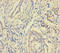 Malignant T cell-amplified sequence 1 antibody, A51401-100, Epigentek, Immunohistochemistry paraffin image 
