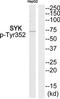 Spleen Associated Tyrosine Kinase antibody, TA326174, Origene, Western Blot image 