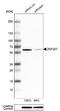 Zinc Finger Protein 207 antibody, NBP1-89550, Novus Biologicals, Western Blot image 