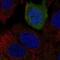 Substance-K receptor antibody, NBP2-69018, Novus Biologicals, Immunofluorescence image 