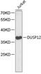 Dual Specificity Phosphatase 12 antibody, 18-789, ProSci, Western Blot image 