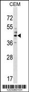 Carcinoembryonic Antigen Related Cell Adhesion Molecule 6 antibody, 59-492, ProSci, Western Blot image 
