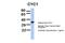 Cytochrome C1 antibody, NBP1-54770, Novus Biologicals, Western Blot image 